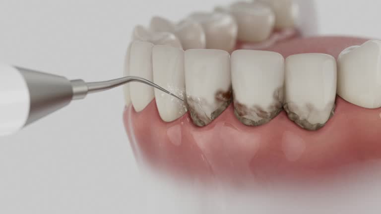 Reliable Dental Implants contractor in Leesburg, OH by Smile Center Dentistry